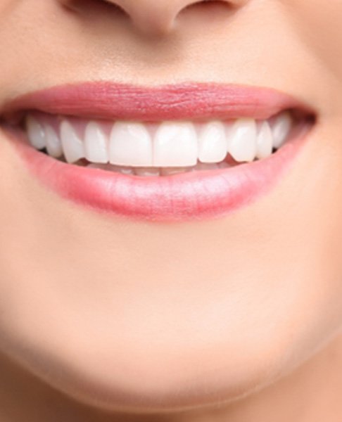The smiling mouth of a woman who received cosmetic dental bonding