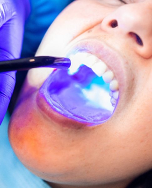 A patient receiving tooth-colored resin for care