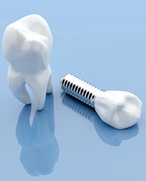 Animated tooth and dental implant supported replacement tooth