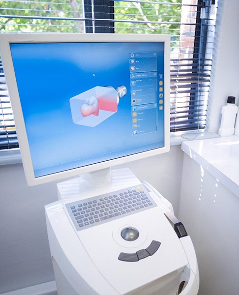 iTero 5D Scanner in dental office