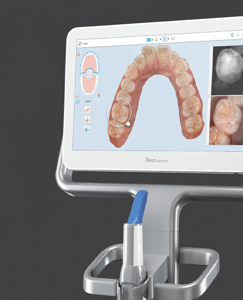iTero 5D Scanner in dental office