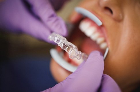 patient getting Invisalign in Collegeville 