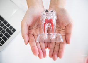 a person holding a replica of an infected tooth that needs root canal therapy